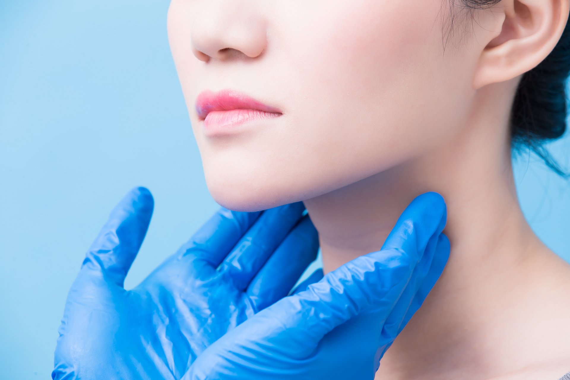 Acne Article - main image