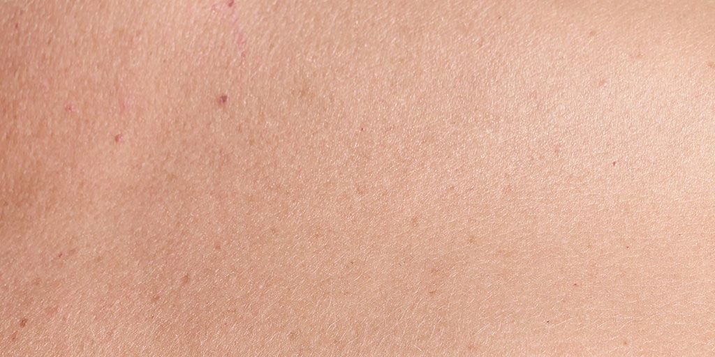 Facial redness skin flushing erythrosis androsacea skin redness causes ...