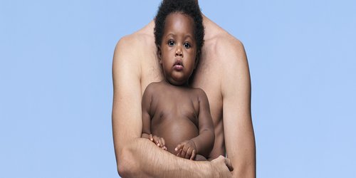 lrp-eczema-babies-children-header-RightsEnd 2023-12-31